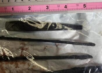 Ақтау дәрігерлері науқас асқазанынан 15-18 см болатын бірнеше темір алып шыққан