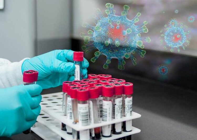 Қазақстанда өткен тәулікте коронавируспен ауырған 5 науқас тіркелді