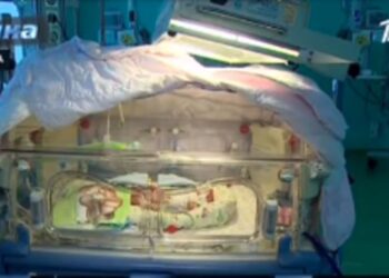 Бетіңізге жағатын кремдер шетінеген балалардан жасалатынын білетін бе едіңіз?