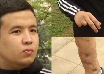 «Аяғы шіріп жатыр»: Тағы бір сарбаз әскерден мүгедек болып оралды