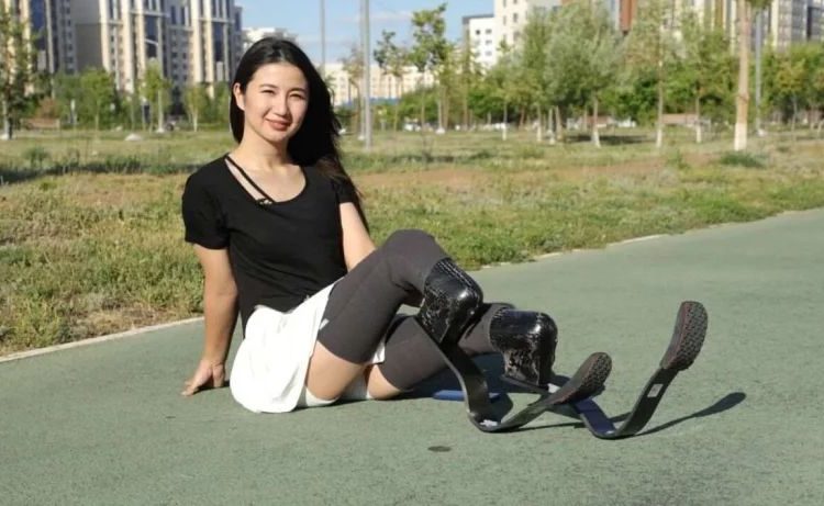 «Аяғымды кеспесе, өміріме қауіп төнетінін айтты»: Астаналық ару батылдығымен көпті тәнті етті